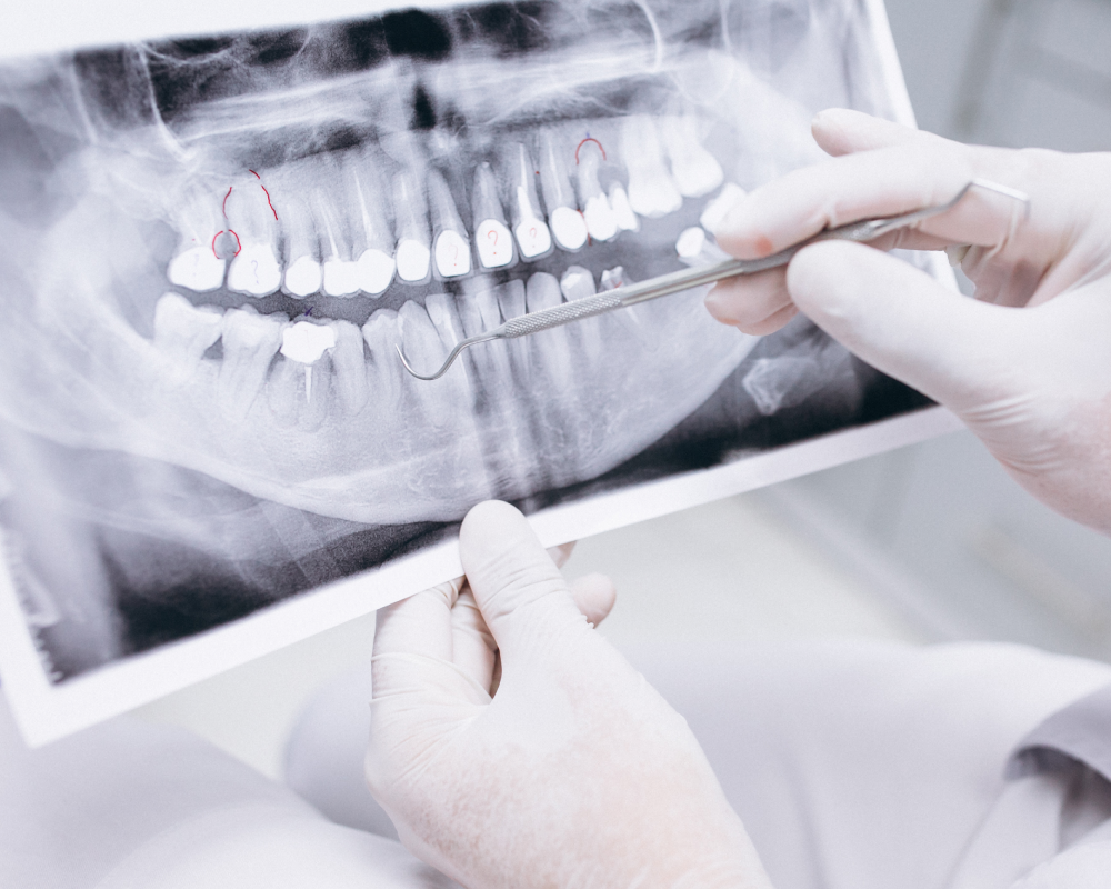 Esseti_dentista_magenta_radiologia